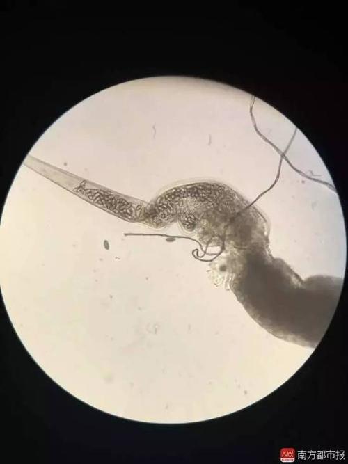 cc/显微镜下的蛔虫,用显微镜观察蛔虫长什么样子